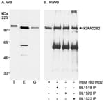 Detection of human KIAA0082 by western blot and immunoprecipitation.