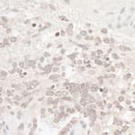Detection of mouse CKII Alpha by immunohistochemistry.