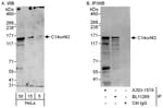 Detection of human C14orf43 by western blot and immunoprecipitation.