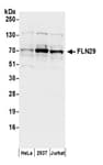 Detection of human FLN29 by western blot.