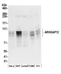 Detection of human and mouse ARHGAP12 by western blot.