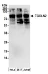 Detection of human TGOLN2 by western blot.