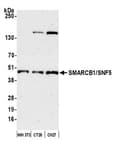 Detection of mouse SMARCB1/SNF5 by western blot.
