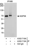 Detection of human NOP58 by western blot of immunoprecipitates.