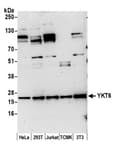 Detection of human and mouse YKT6 by western blot.