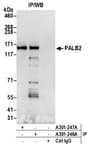Detection of human PALB2 by western blot of immunoprecipitates.