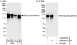 Detection of human SF3b155/SAP155 by western blot and immunoprecipitation.