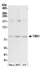 Detection of human and mouse TBK1 by western blot.