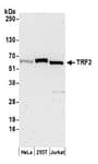 Detection of human TRF2 by western blot.