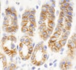 Detection of mouse KIAA0528 by immunohistochemistry.