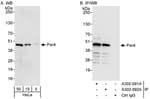 Detection of human Par4 by western blot and immunoprecipitation.