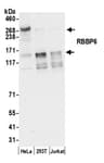 Detection of human RBBP6 by western blot.