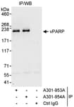 Detection of human vPARP by western blot of immunoprecipitates.