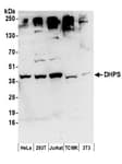 Detection of human and mouse DHPS by western blot.