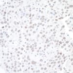 Detection of mouse BAF53A by immunohistochemistry.