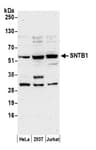 Detection of human SNTB1 by western blot.