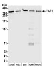 Detection of human and mouse TAF1 by western blot.
