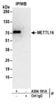 Detection of human METTL16 by western blot of immunoprecipitates.