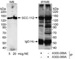 Detection of human SCC-112 by western blot and immunoprecipitation.