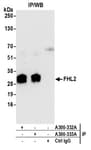 Detection of human FHL2 by western blot of immunoprecipitates.