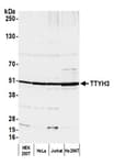 Detection of human TTYH3 by western blot.