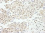 Detection of human TDP1 by immunohistochemistry.