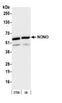 Detection of mouse and rat NONO by western blot.
