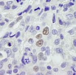 Detection of human INT11 by immunohistochemistry.