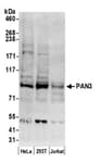 Detection of human PAN3 by western blot.