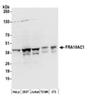 Detection of human and mouse FRA10AC1 by western blot.