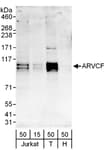 Detection of human ARVCF by western blot.