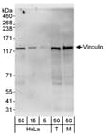 Detection of human and mouse Vinculin by western blot.