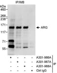 Detection of human ARG by western blot of immunoprecipitates.