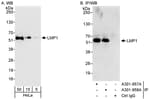 Detection of human LMP1 by western blot and immunoprecipitation.