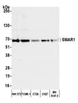 Detection of mouse SMAR1 by western blot.