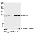 Detection of human Bcl11a by western blot.