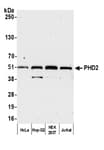 Detection of human PHD2 by western blot.