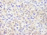 Detection of mouse CSN2 by immunohistochemistry.