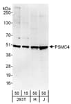 Detection of human PSMC4 by western blot.