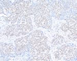Detection of human hSET1 by immunohistochemistry.