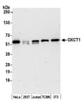 Detection of human and mouse OXCT1 by western blot.