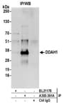 Detection of human DDAH1 by western blot of immunoprecipitates.