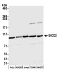 Detection of human BICD2 by western blot.