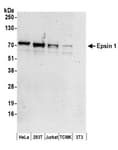 Detection of human and mouse Epsin 1 by western blot.