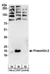 Detection of human Presenilin-2 by western blot.