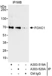 Detection of human FOXC1 by western blot of immunoprecipitates.