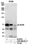 Detection of human NCDN by western blot of immunoprecipitates.