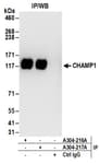 Detection of human CHAMP1 by western blot of immunoprecipitates.