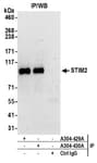 Detection of human STIM2 by western blot of immunoprecipitates.