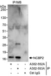 Detection of human NCBP2 by western blot of immunoprecipitates.